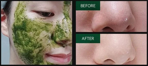 Веганский детокс-пилинг с микроиглами MEDIPEEL E.G.F. Peel Tox, 70 гр