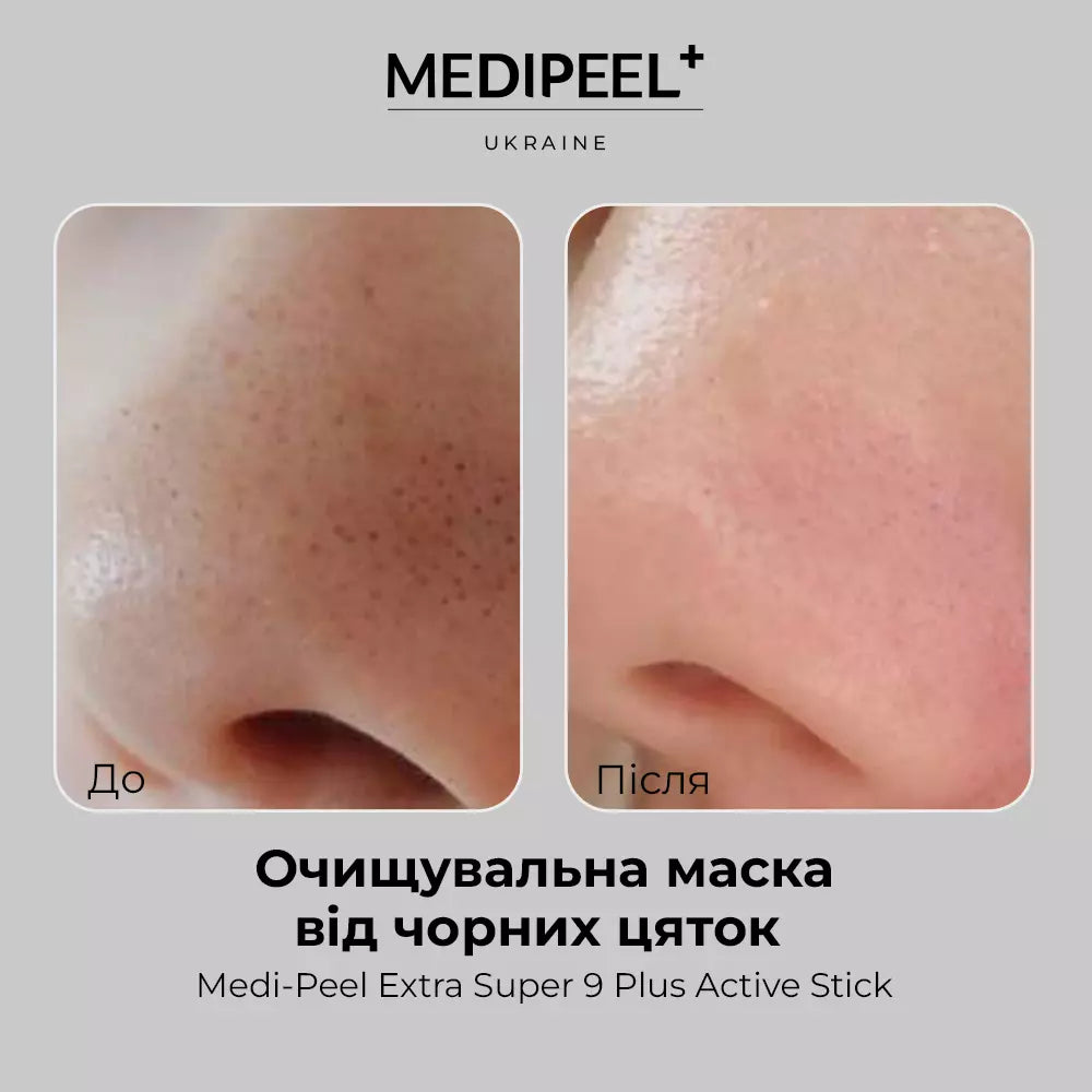 Двухэтапная маска от черных точек MEDIPEEL Extra Super 9 Plus Blackhead Out Nose Pack, 1 шт