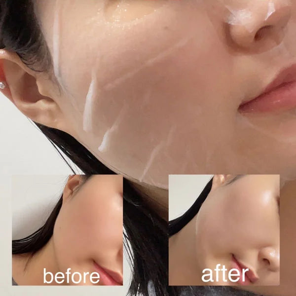 Ампульная маска для лица MEDIPEEL Hyaluron Rose Energy Tox Mask, 1 шт